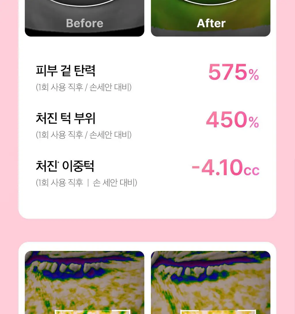 [3D진동클렌징/모공케어] 메디큐브 에이지알 부스터 진동 클렌저 헤드 (베이지/핑크) 상세페이지 56